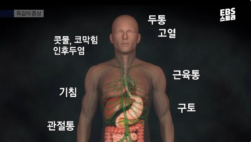 독감의 증상
콧물, 코막힘, 인후두염, 기침, 관절통, 근육통, 구토, 고열