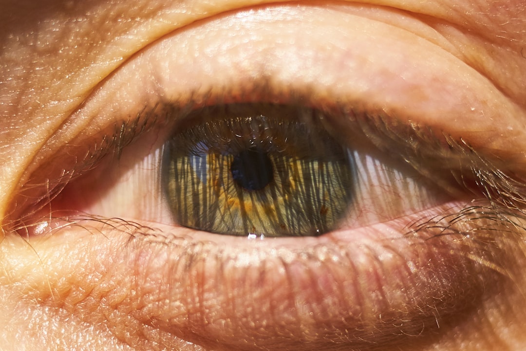 Cataract