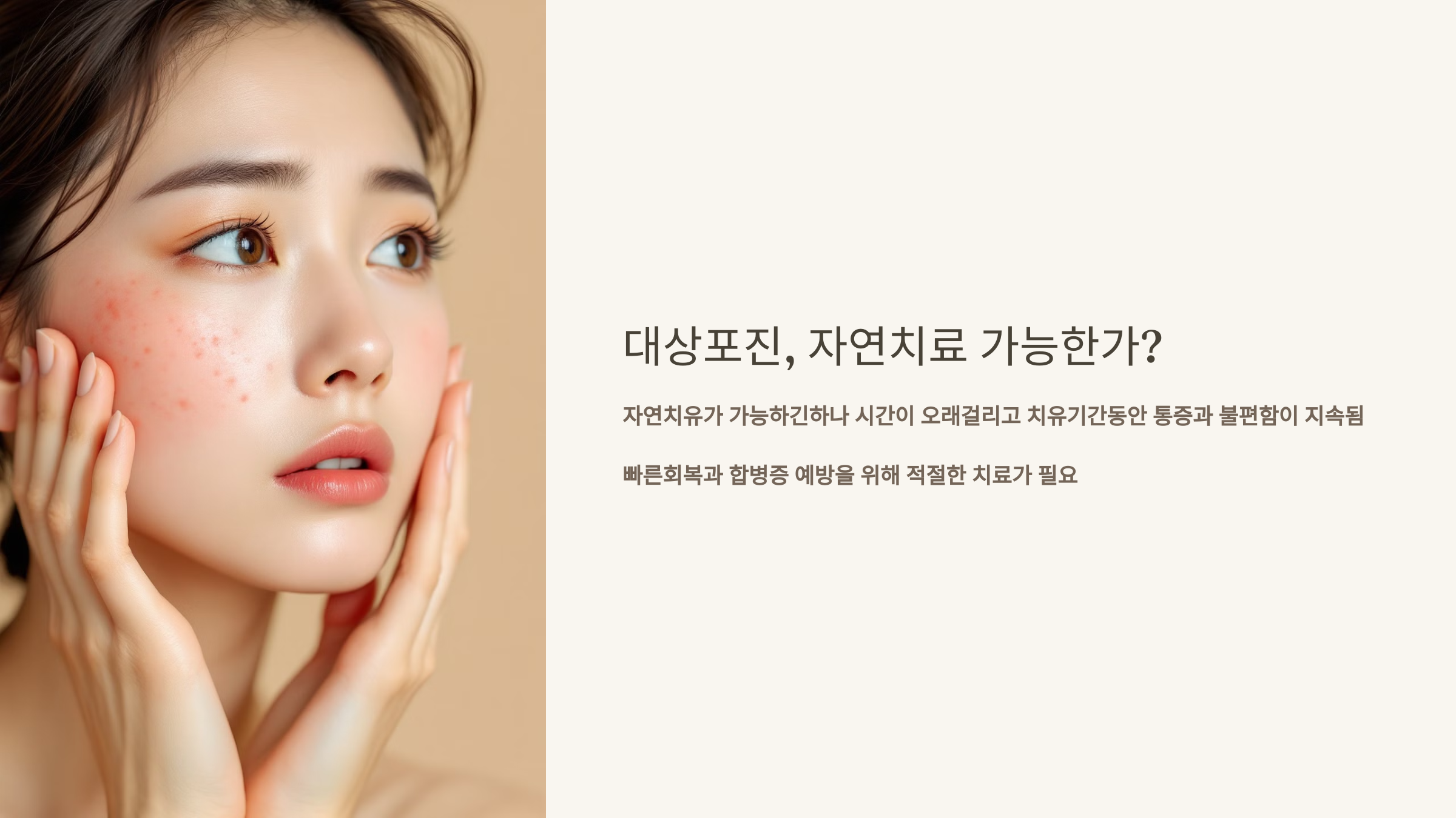 대상포진 자연치료 가능한가?