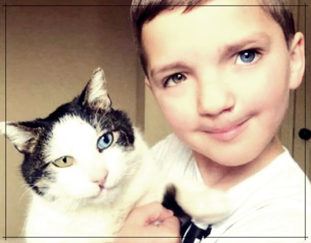 눈 기름샘 청소법: 효과적인 방법 5가지