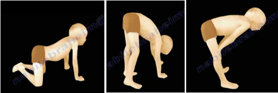 가우어 징후