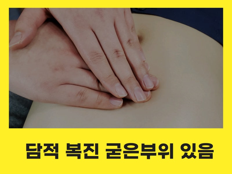 역류성 식도염 속쓰림&amp;#44; 공복과 식후에 다른 이유