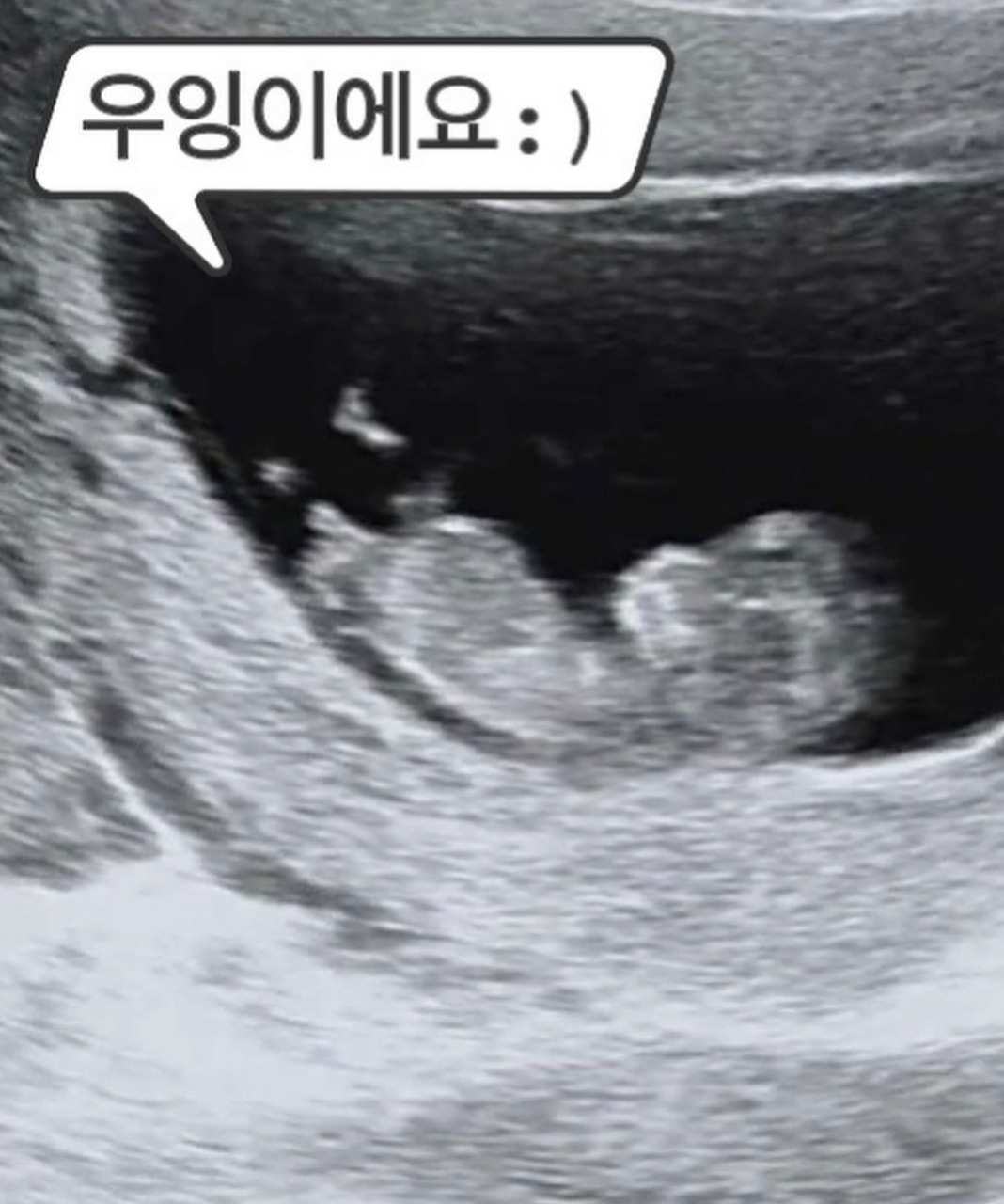 이필모 서수연 임신