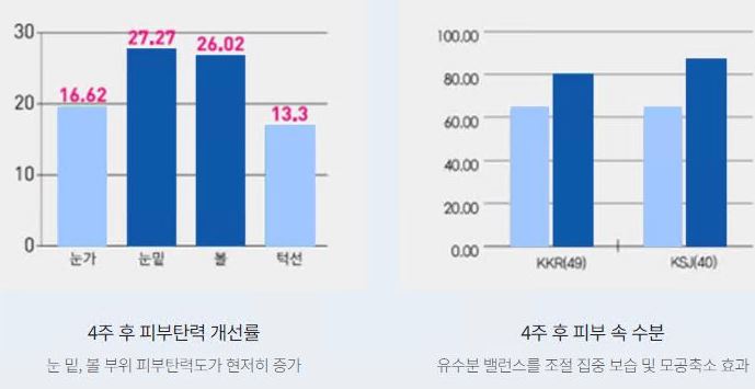 리쥬란-힐러-효과