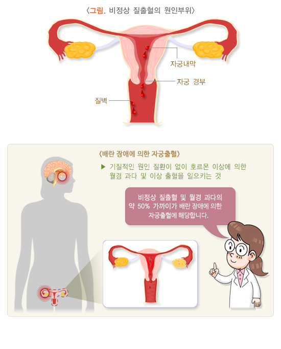 질출혈