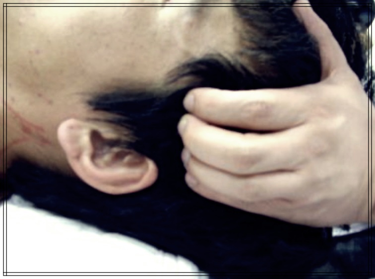 측두근과 건강: 왜 측두근이 중요한가?