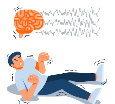 뇌질병으로 쓰러진 남성 일러스트