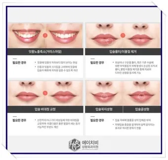 입술 두꺼운 남자 관상 특징과 해석_13