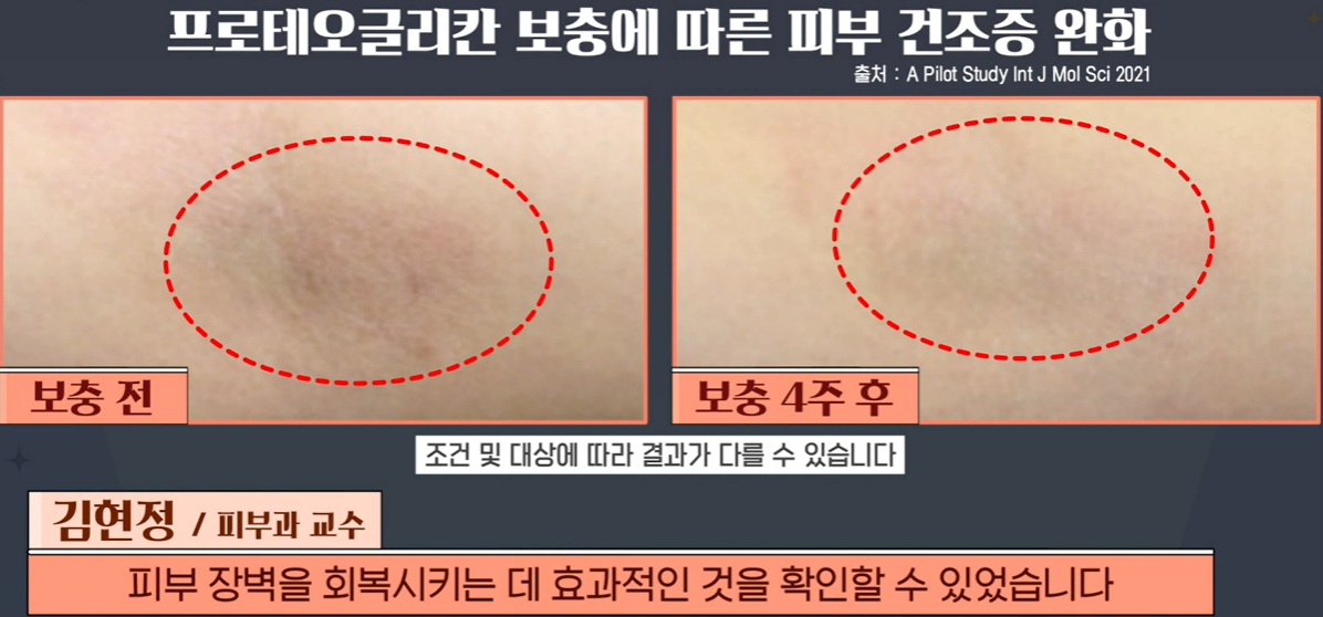 프로테오글리칸 효능