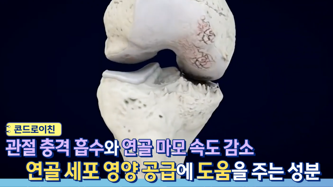콘드로이친