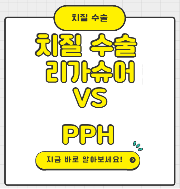 치질수술 리가슈어 VS PPH