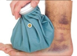 냉찜질과 온찜질의 차이 관련 사진