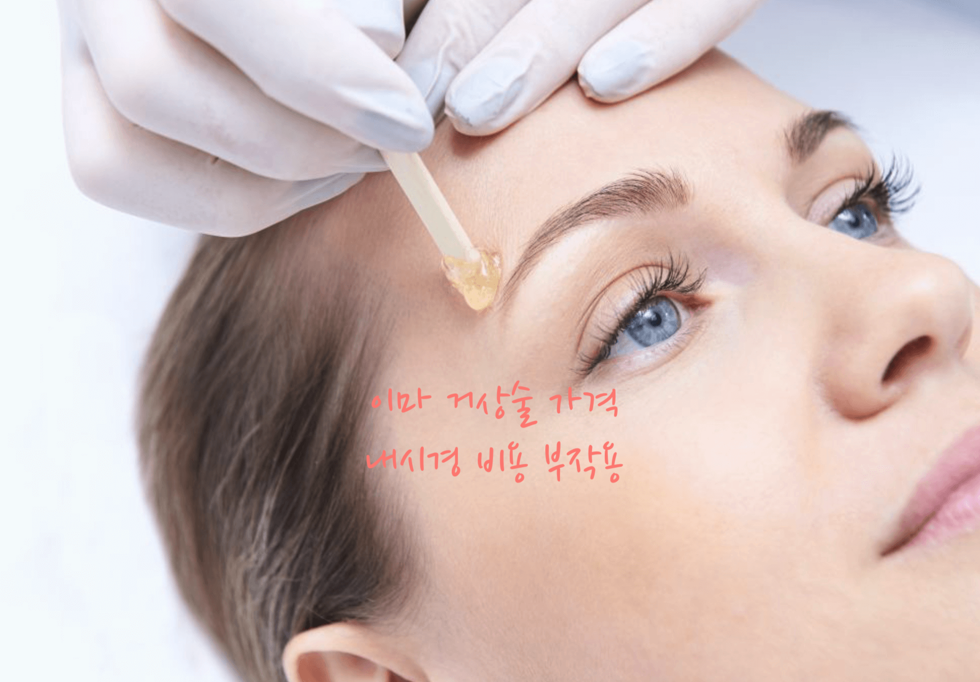 이마 거상술 가격