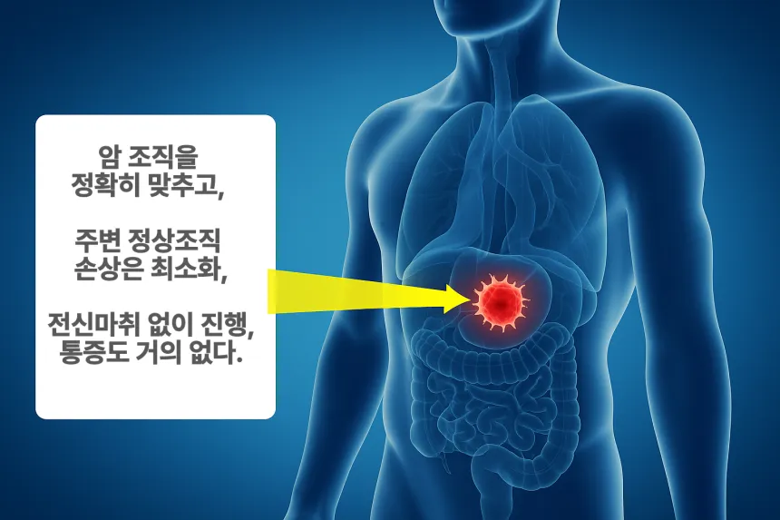 중입자 암치료