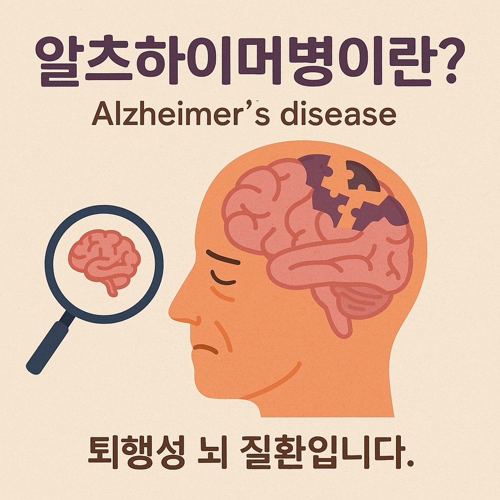 알츠하이머병