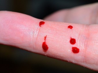 손가락-여섯군데서-붉은-피가-맺히는-장면