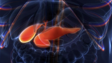 췌장암 초기증상 검사방법 발생원인 총정리(최신)