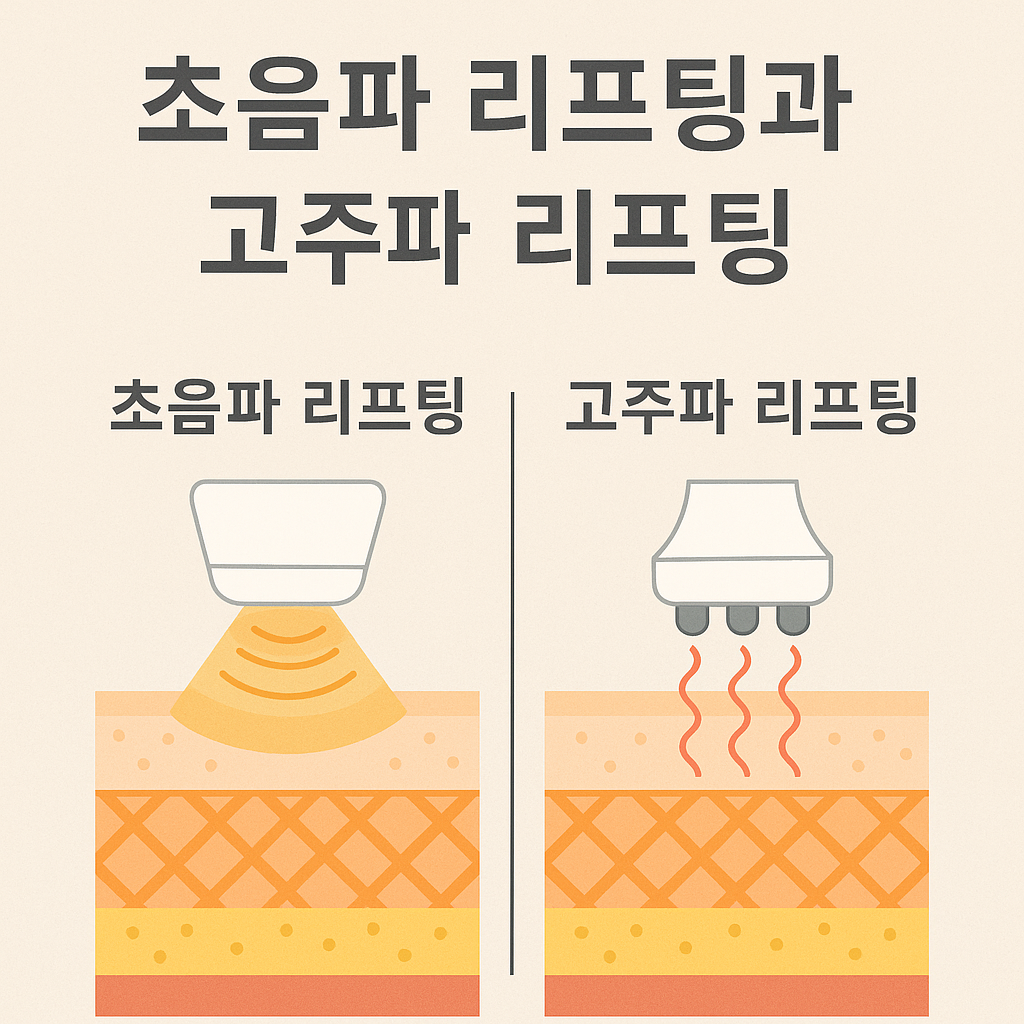 초음파 리프팅과 고주파 리프팅, 차이점과 선택 가이드