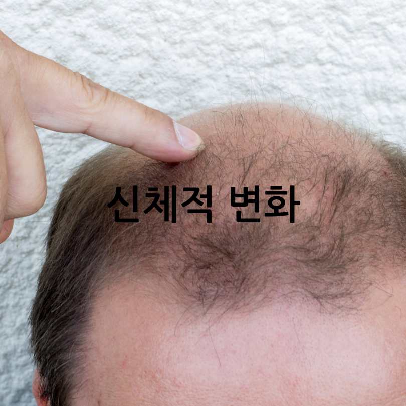 남자 갱년기 증상과 극복방법