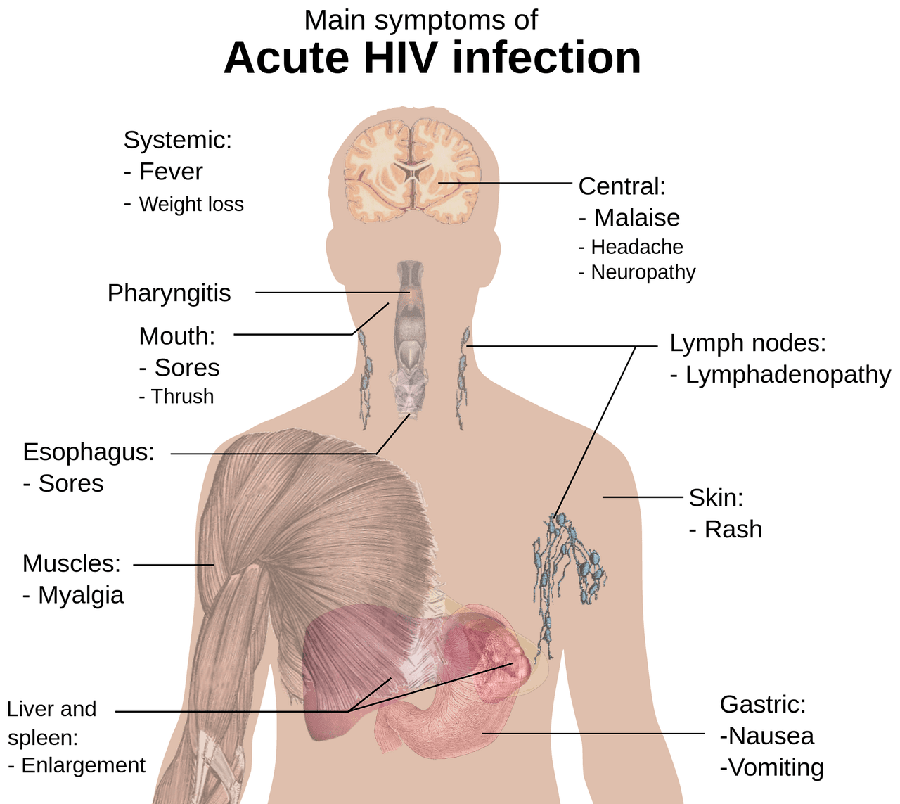 림프가 잘 흐르지 않는 이유