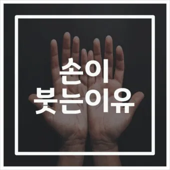 손등 붓는 이유 혈액순환 문제 증상과 해결법 정리_12