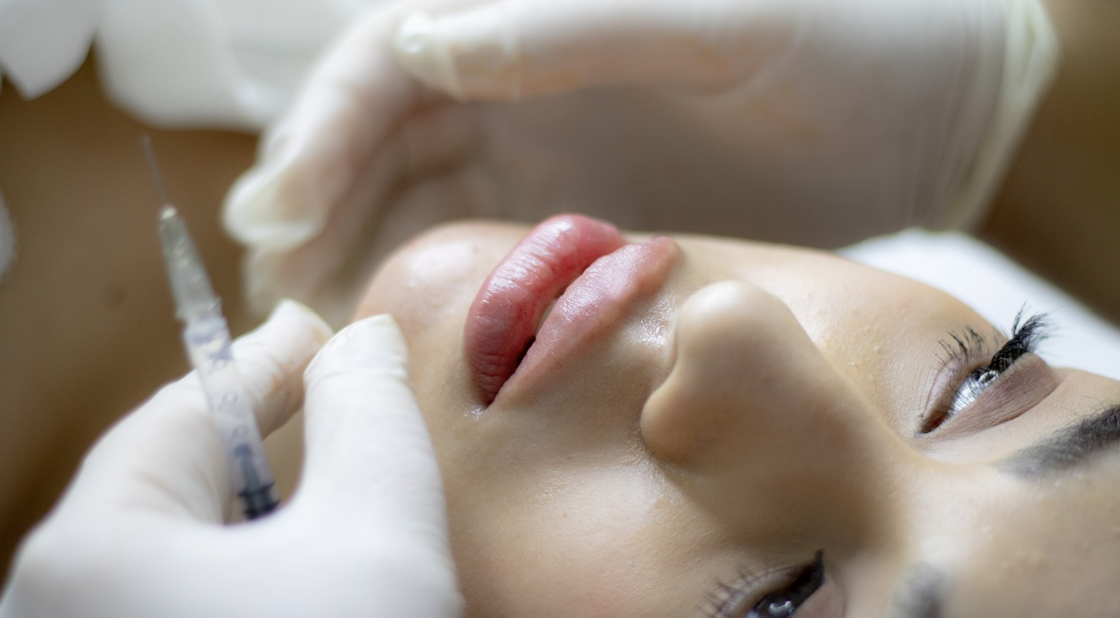 지방이식 시술중인 여성