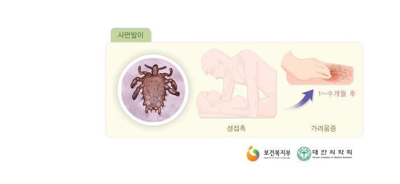 사면발이