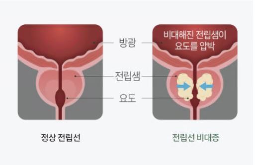 카리토-포텐