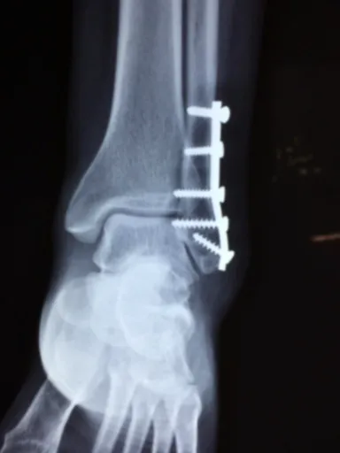 수분 부족이 보내는 SOS 신호