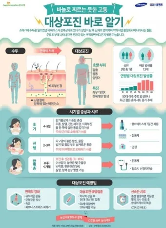대상포진 치료방법에 대한 총정리 건강 질병관리_2