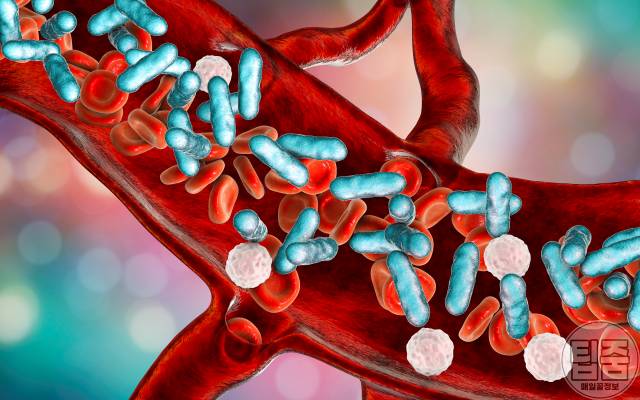 피부에 붉은 선,피부에 붉은자국,패혈증 증상,팁줌