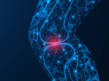 류마티스 관절염