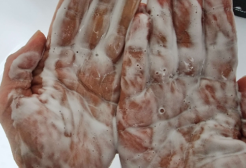 탈모샴푸 마이녹셀