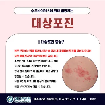 대상포진 감염 증상 부위 손 허리 허벅지_15