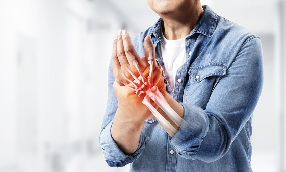 신경손상 이미지