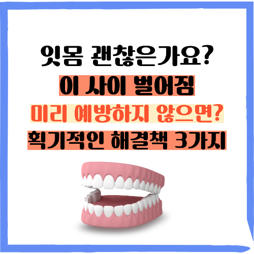 잇몸 치아 벌어짐, 잇몸이 무너지면 전신 건강도 무너집니다! 이 사이 벌어짐, 잇몸 내려앉음 예방 획기적인 해결책 3가지 4050 치주질환