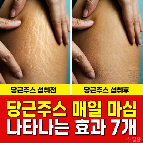 당근주스 효능 튼살 제거 셀룰라이트