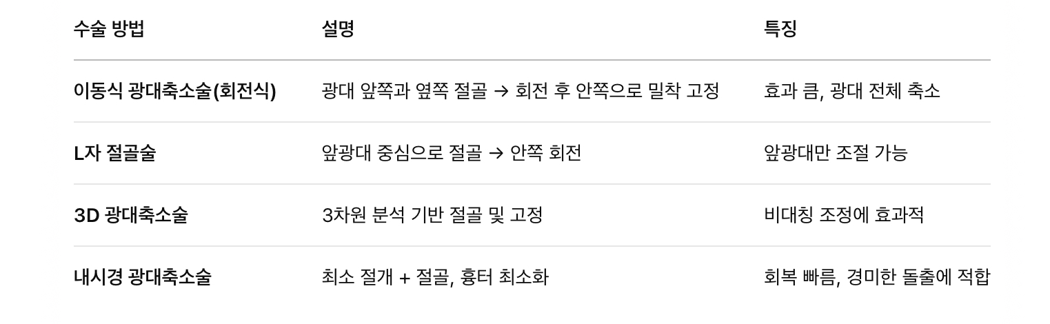 광대축소술의 종류