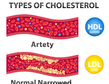 hdl 콜레스테롤 이란? 정상수치 및 높이는 방법