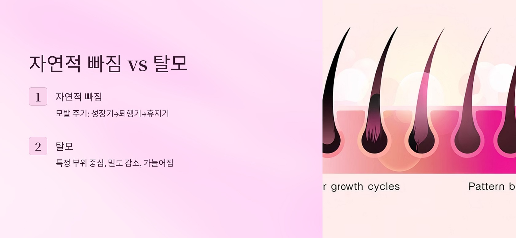 탈모와 자연스러운 빠짐의 차이