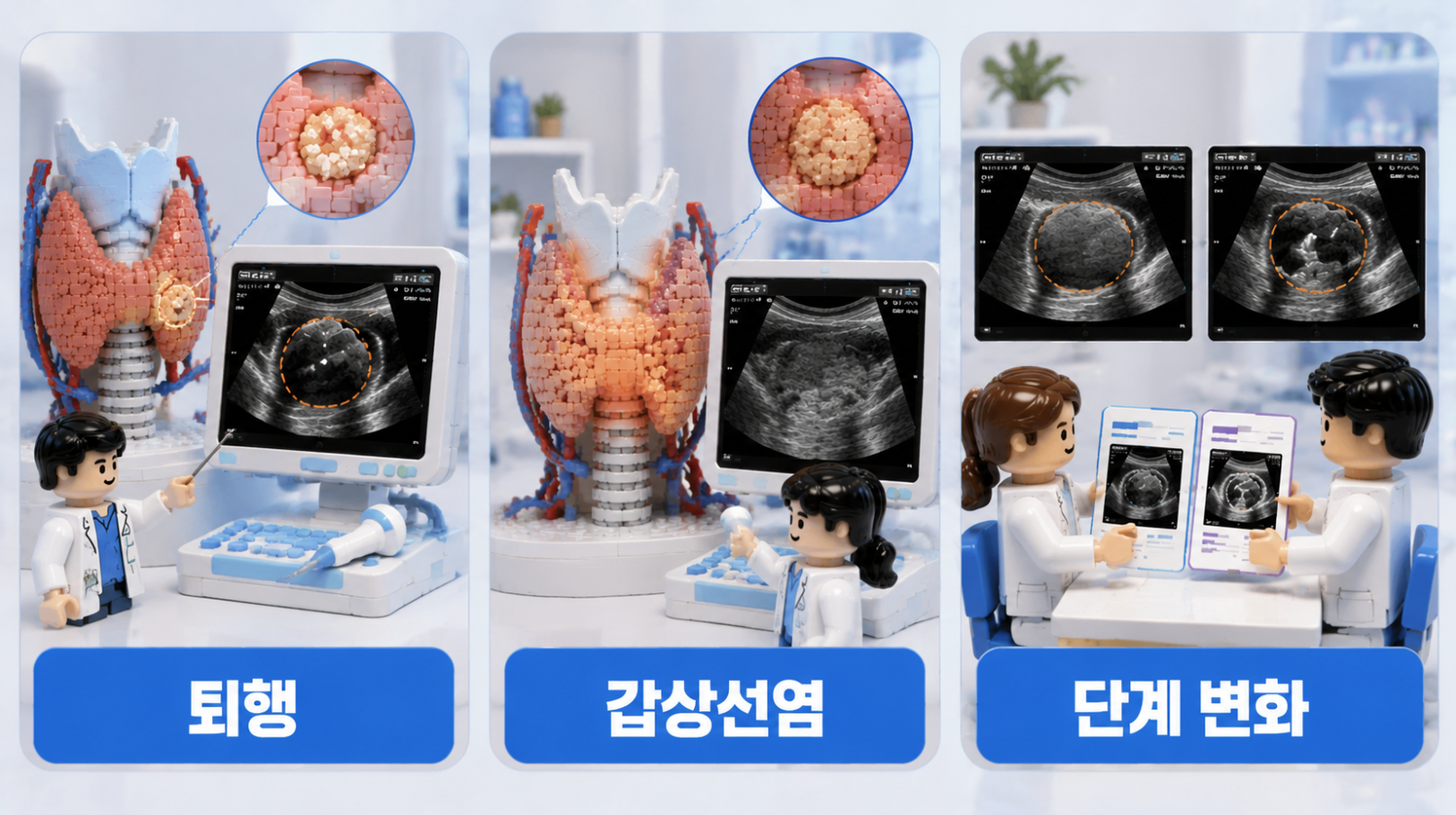퇴행성 결절과 갑상선염, 촬영 단면 차이로 K-TIRADS 단계가 달라질 수 있는 상황