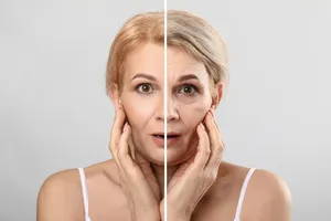 하안검 수술 회복기간