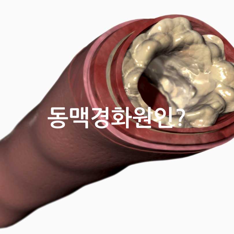 혈관건강관리