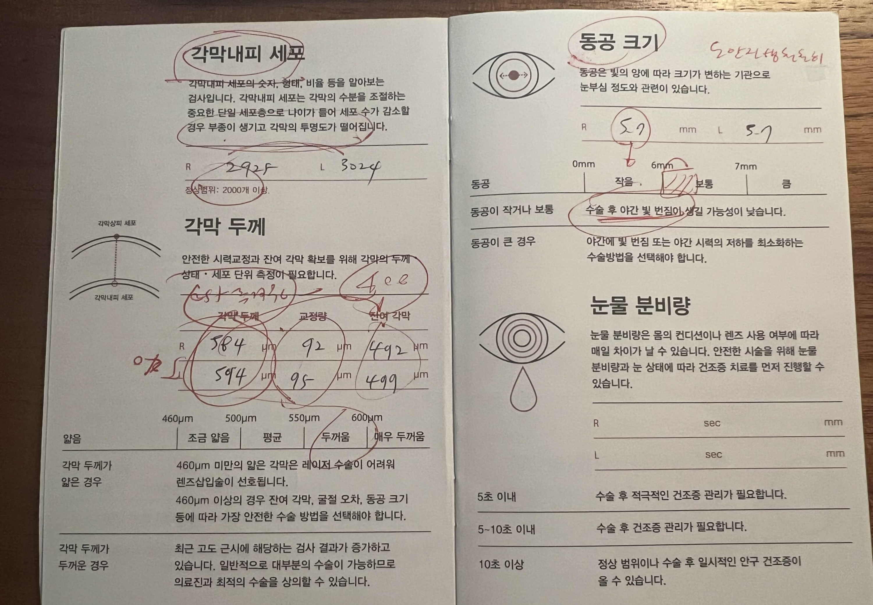각막 두께