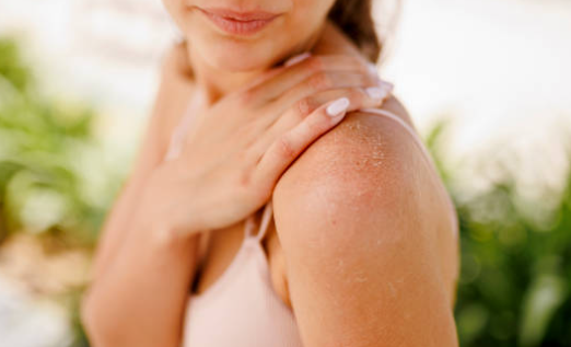 갑상선 기능 저하증