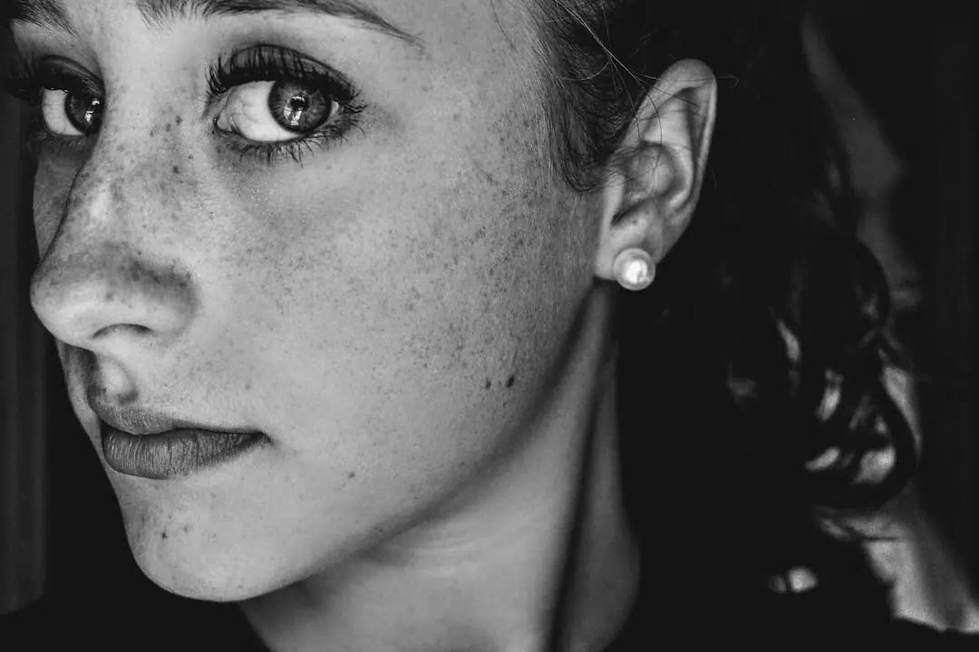 기미가 있는 여성33