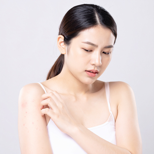 심한 경우 아나필락시스(전신 알레르기 반응)으로 이어질 수 있습니다