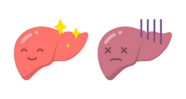 간수치를 낮추는 가장 현실적인 방법