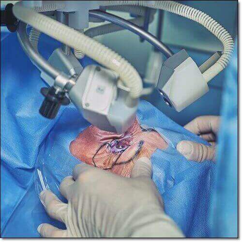 노인성 황반변성 원인, 및 치료