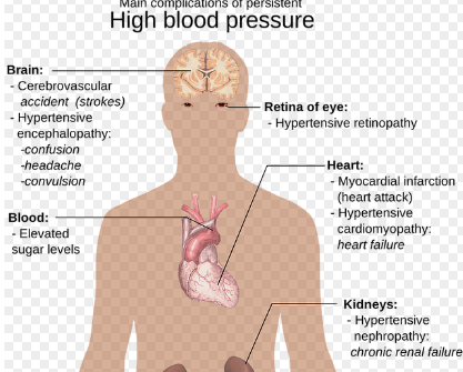 관절염과 합병증